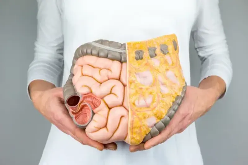 Ozonioterapeuta para tratamento intestinal