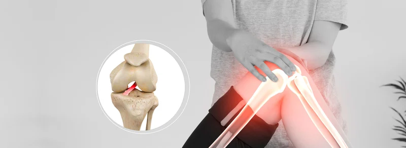 Tratamento de fisioterapia para lesão de ligamento cruzado