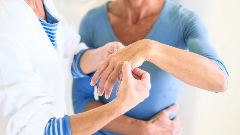 Fisioterapeuta para tratamento de artrite reumatoide